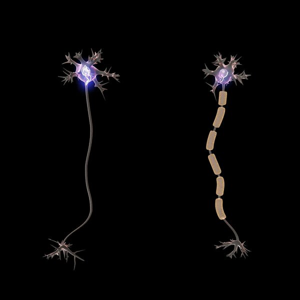 A USB Port for Your Body? Startup Uses AI to Connect Medical Devices to Nervous System - Ep. 59