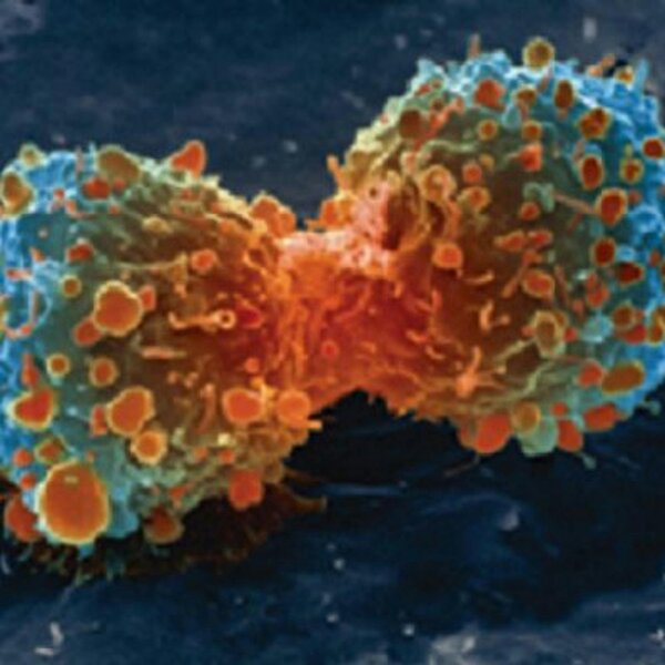 Ep. 52: Live at GTC - How Deep Learning Can Fight Cancer